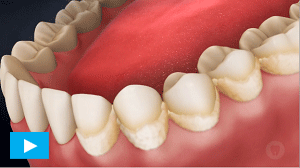 Oral Health in Etobicoke